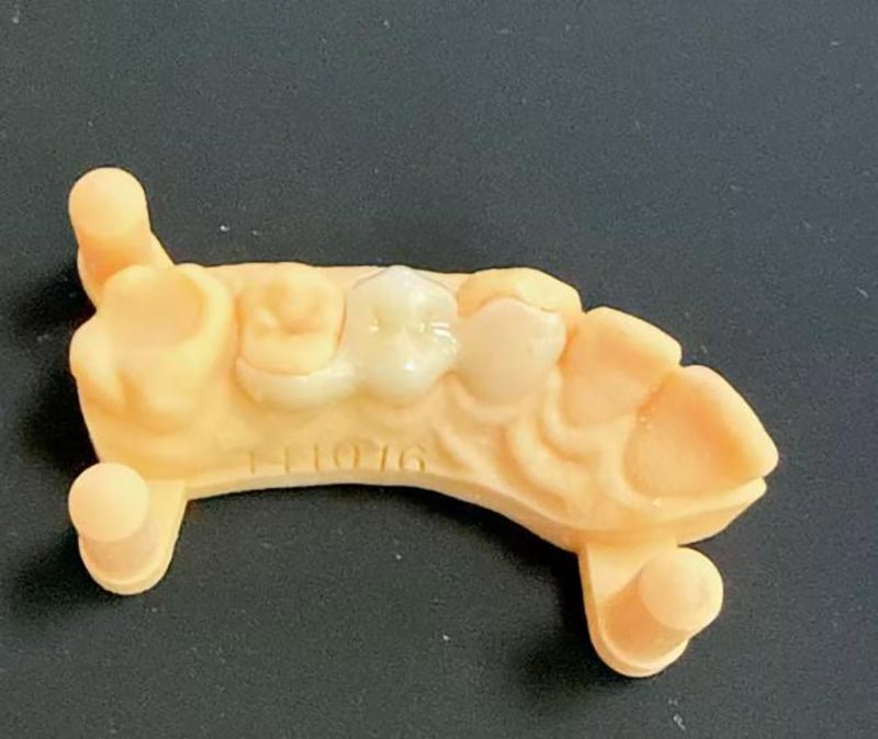 மேரிலாந்து பாலங்கள் பற்றி நீங்கள் தெரிந்து கொள்ள வேண்டியது என்ன?