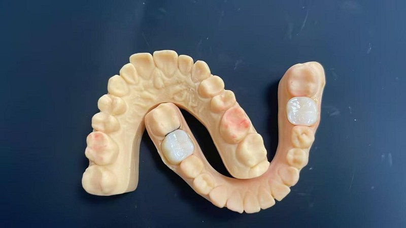 தோள்பட்டை விளிம்பு என்ன?