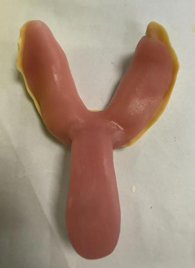 தனிப்பயன் பல் தட்டுகளைப் பற்றி உங்களுக்குத் தெரியாத விஷயங்கள்